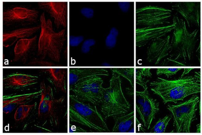 Mouse IgG (H+L) Highly Cross-Adsorbed Secondary Antibody in Immunocytochemistry (ICC/IF)