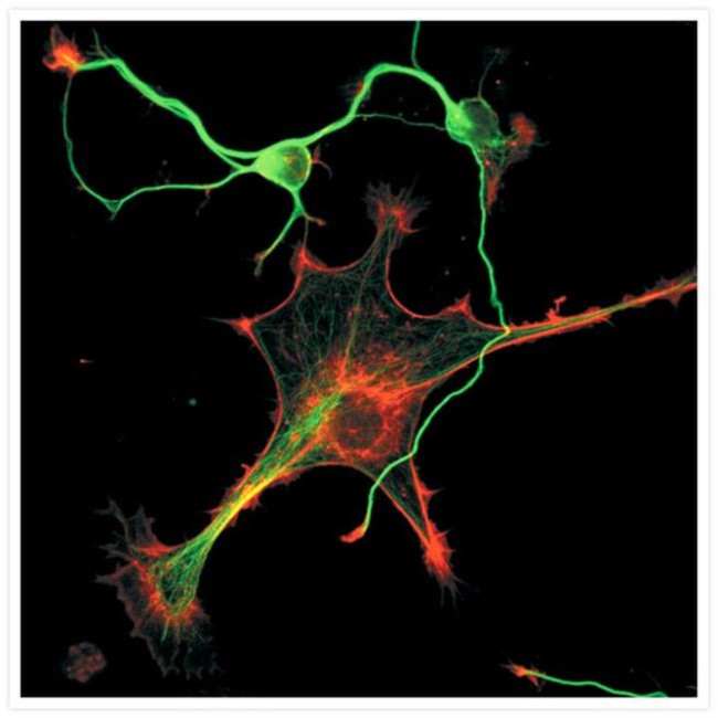 Mouse IgG (H+L) Cross-Adsorbed Secondary Antibody in Immunocytochemistry (ICC/IF)