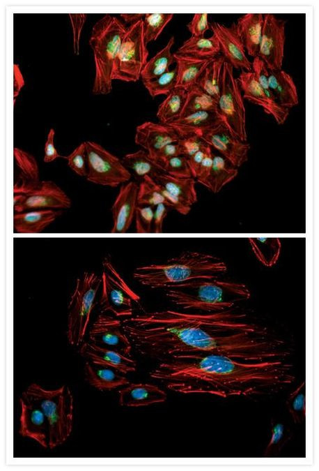 Mouse IgG (H+L) Cross-Adsorbed Secondary Antibody in Immunocytochemistry (ICC/IF)