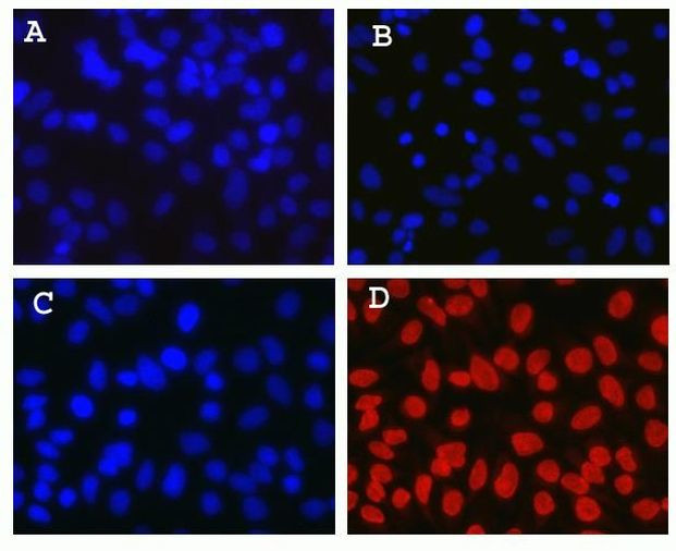 Mouse IgG (H+L) Cross-Adsorbed Secondary Antibody in Immunocytochemistry (ICC/IF)