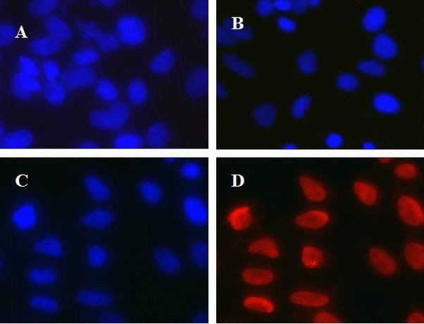 Mouse IgG (H+L) Cross-Adsorbed Secondary Antibody in Immunocytochemistry (ICC/IF)