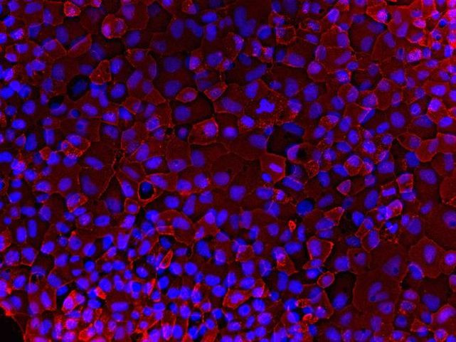 Mouse IgG (H+L) Cross-Adsorbed Secondary Antibody in Immunocytochemistry (ICC/IF)