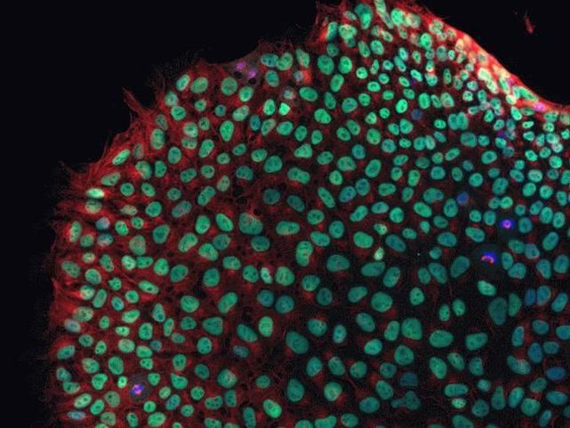 Mouse IgG (H+L) Cross-Adsorbed Secondary Antibody in Immunocytochemistry (ICC/IF)