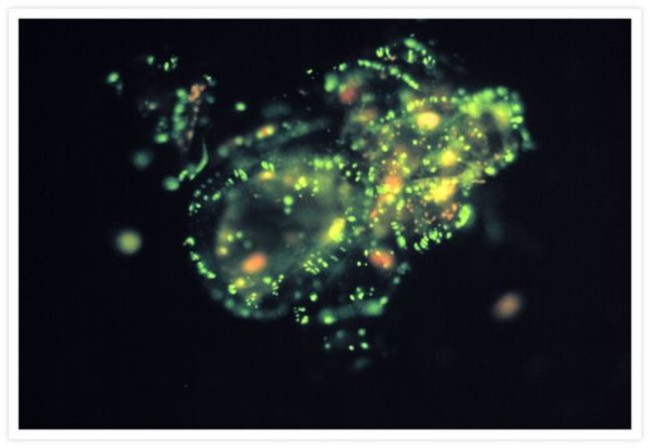 Rat IgG (H+L) Cross-Adsorbed Secondary Antibody in Immunocytochemistry (ICC/IF)