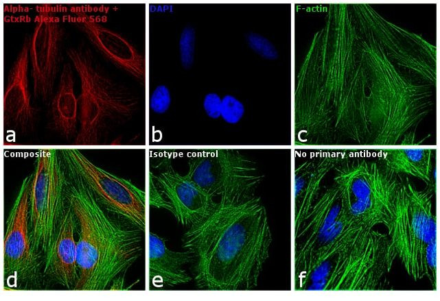 Rabbit IgG (H+L) Cross-Adsorbed Secondary Antibody in Immunocytochemistry (ICC/IF)