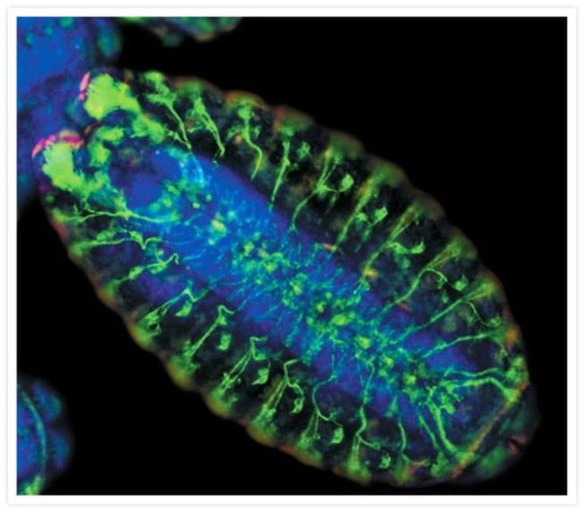 Rabbit IgG (H+L) Cross-Adsorbed Secondary Antibody in Immunocytochemistry (ICC/IF)