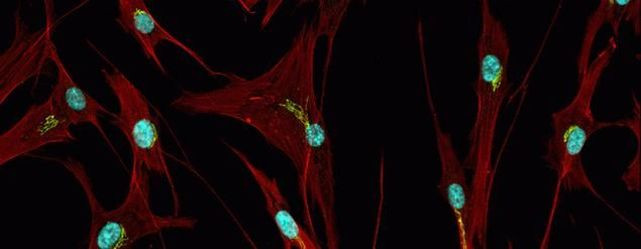 Mouse IgG (H+L) Highly Cross-Adsorbed Secondary Antibody in Immunocytochemistry (ICC/IF)