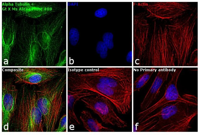 Mouse IgG (H+L) Highly Cross-Adsorbed Secondary Antibody in Immunocytochemistry (ICC/IF)