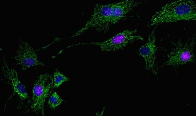 Mouse IgG (H+L) Highly Cross-Adsorbed Secondary Antibody in Immunocytochemistry (ICC/IF)