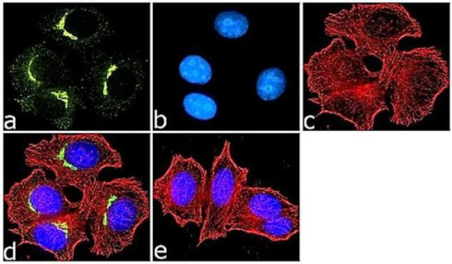 Mouse IgG (H+L) Highly Cross-Adsorbed Secondary Antibody in Immunocytochemistry (ICC/IF)