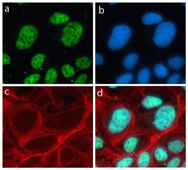 Rabbit IgG (H+L) Highly Cross-Adsorbed Secondary Antibody in Immunocytochemistry (ICC/IF)