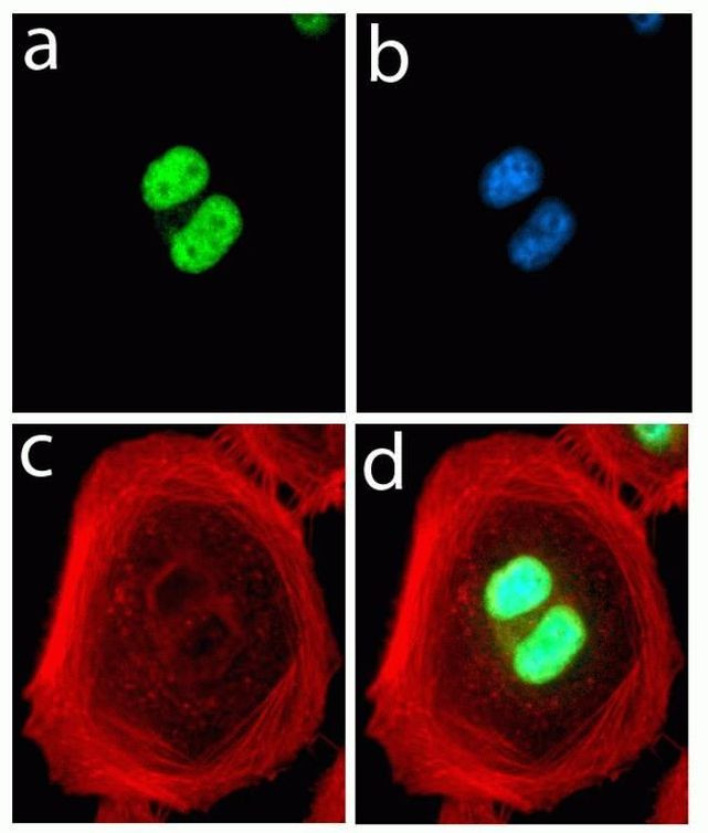 Rabbit IgG (H+L) Highly Cross-Adsorbed Secondary Antibody in Immunocytochemistry (ICC/IF)