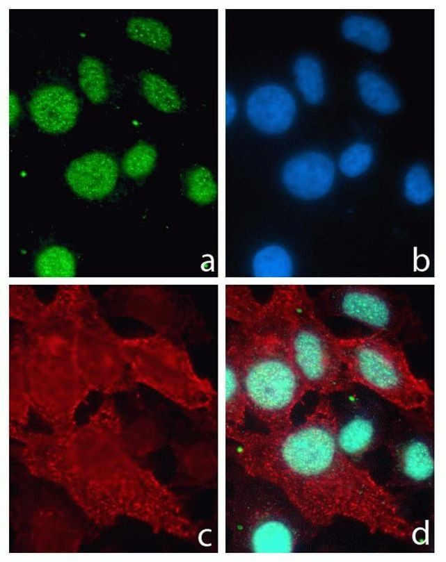 Rabbit IgG (H+L) Highly Cross-Adsorbed Secondary Antibody in Immunocytochemistry (ICC/IF)