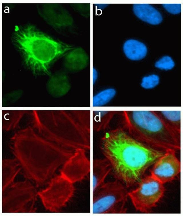 Rabbit IgG (H+L) Highly Cross-Adsorbed Secondary Antibody in Immunocytochemistry (ICC/IF)