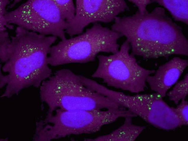 Rabbit IgG (H+L) Highly Cross-Adsorbed Secondary Antibody in Immunocytochemistry (ICC/IF)