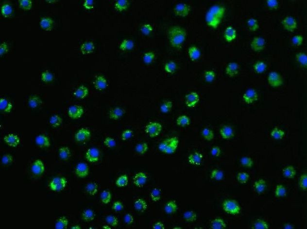 Rabbit IgG (H+L) Highly Cross-Adsorbed Secondary Antibody in Immunocytochemistry (ICC/IF)