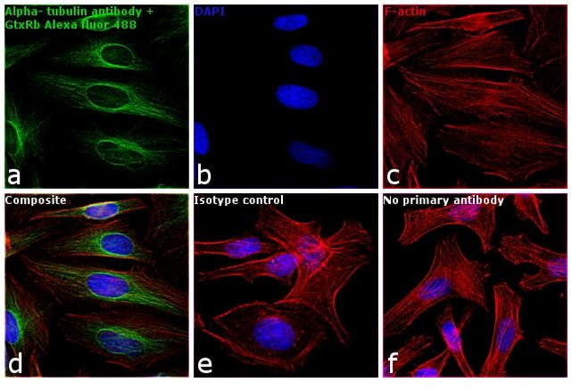 Rabbit IgG (H+L) Highly Cross-Adsorbed Secondary Antibody in Immunocytochemistry (ICC/IF)