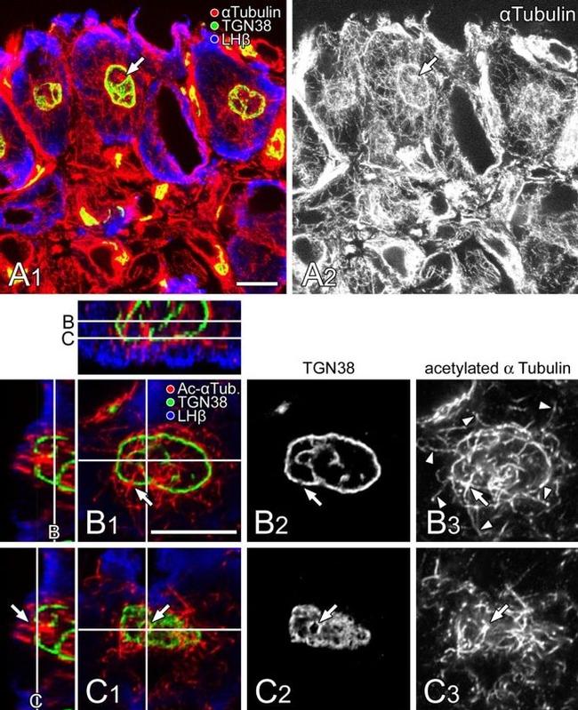 alpha Tubulin Antibody in Immunohistochemistry (IHC)