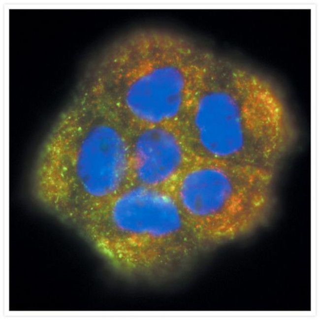 Transferrin Receptor Antibody in Immunocytochemistry (ICC/IF)