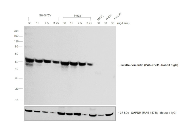 Rabbit IgG (H+L) Highly Cross-Adsorbed Secondary Antibody in Western Blot (WB)