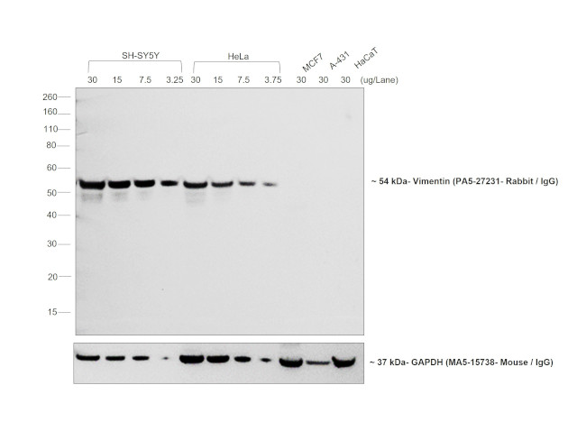 Rabbit IgG (H+L) Highly Cross-Adsorbed Secondary Antibody in Western Blot (WB)