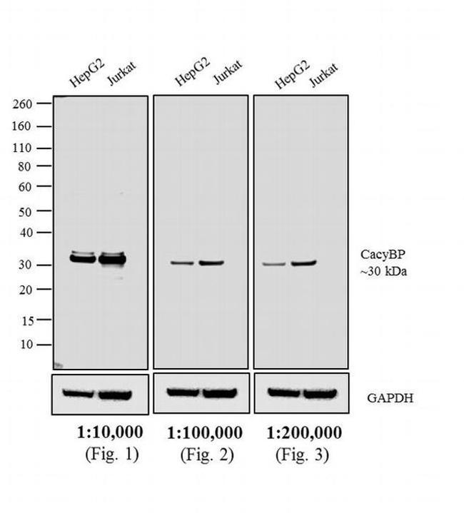 Rabbit IgG (H+L) Highly Cross-Adsorbed Secondary Antibody in Western Blot (WB)