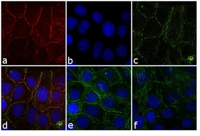 Rabbit IgG (H+L) Highly Cross-Adsorbed Secondary Antibody in Immunocytochemistry (ICC/IF)