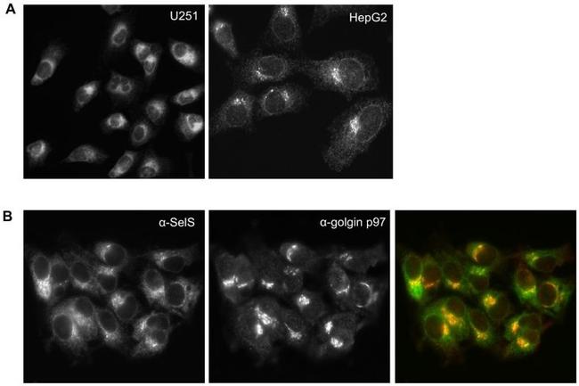 Golgin-97 Antibody in Immunocytochemistry (ICC/IF)