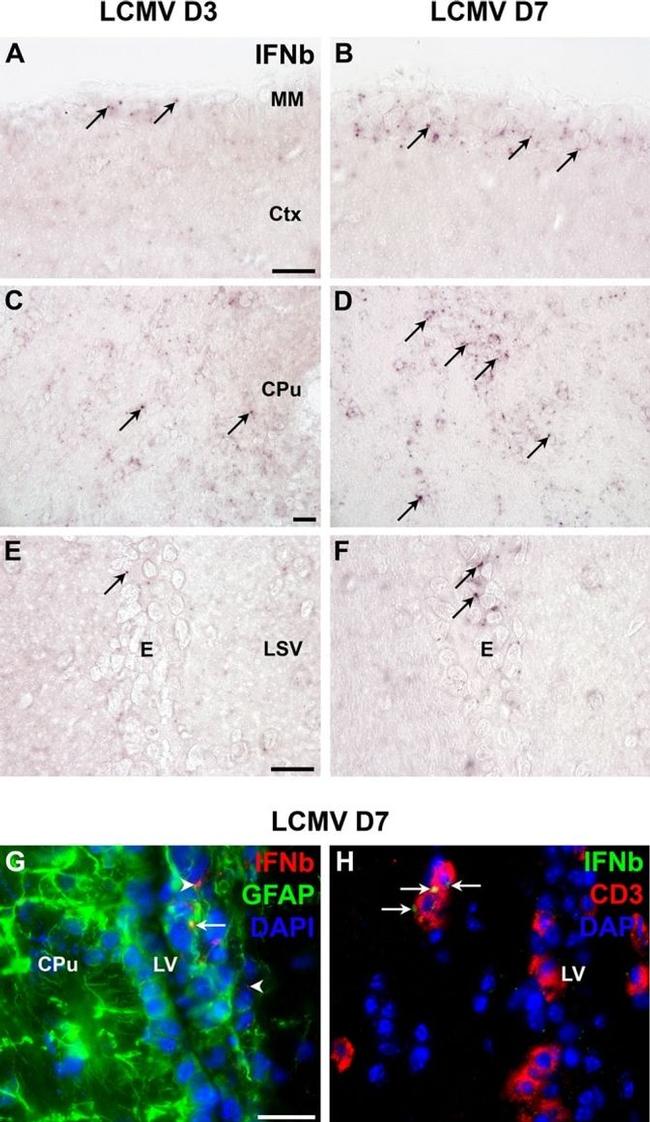 GFAP Antibody in Immunohistochemistry (IHC)