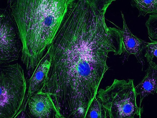 ATPIF1 Antibody in Immunocytochemistry (ICC/IF)