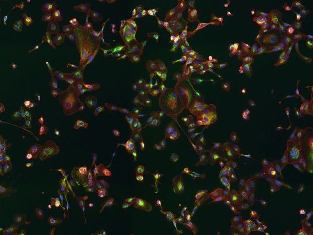 ATPIF1 Antibody in Immunocytochemistry (ICC/IF)