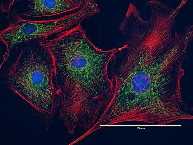 ATPIF1 Antibody in Immunocytochemistry (ICC/IF)