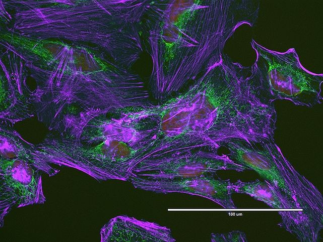 ATPIF1 Antibody in Immunocytochemistry (ICC/IF)