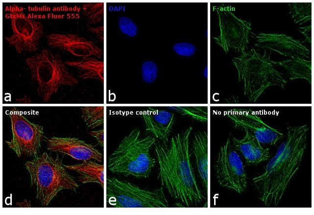 Mouse IgG (H+L) Cross-Adsorbed Secondary Antibody in Immunocytochemistry (ICC/IF)