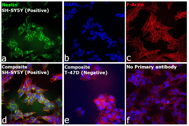 Mouse IgG (H+L) Secondary Antibody in Immunocytochemistry (ICC/IF)