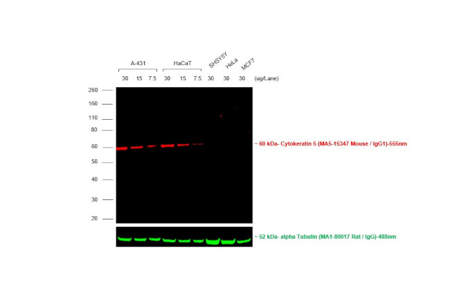 Mouse IgG (H+L) Secondary Antibody in Western Blot (WB)