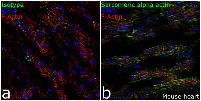 Rabbit IgG (Heavy chain) Secondary Antibody in Immunohistochemistry (Frozen) (IHC (F))