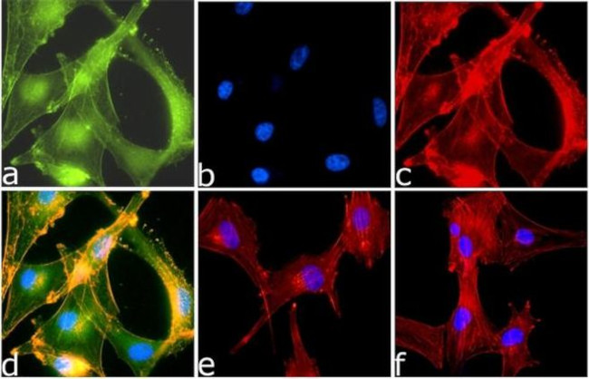 Rabbit IgG (Heavy chain) Secondary Antibody in Immunocytochemistry (ICC/IF)