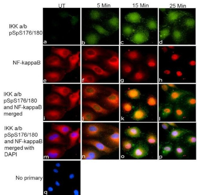 Rabbit IgG (Heavy chain) Secondary Antibody in Immunocytochemistry (ICC/IF)