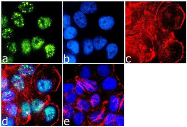 Rabbit IgG (Heavy chain) Secondary Antibody in Immunocytochemistry (ICC/IF)