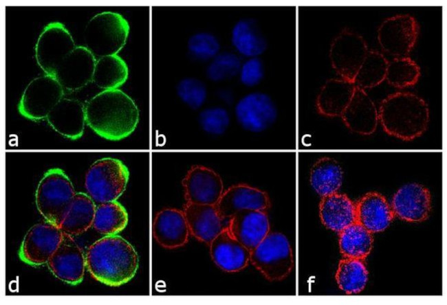 Rabbit IgG (Heavy chain) Secondary Antibody in Immunocytochemistry (ICC/IF)