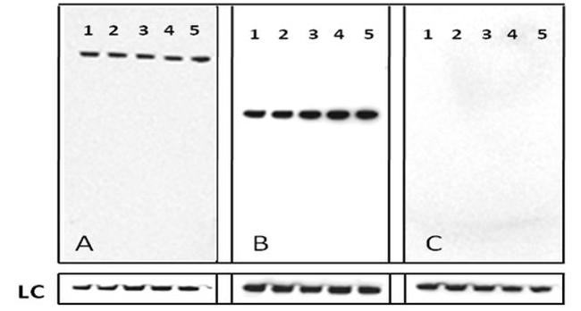 Rabbit IgG (Heavy chain) Secondary Antibody in Western Blot (WB)