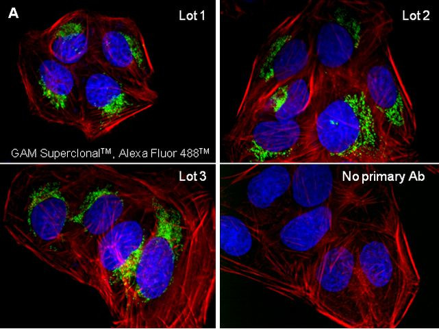 Mouse IgG (H+L) Secondary Antibody in Immunocytochemistry (ICC/IF)