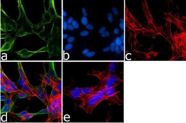 Mouse IgG (H+L) Secondary Antibody in Immunocytochemistry (ICC/IF)