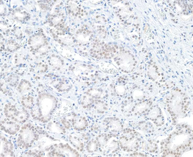 BAP1 Antibody in Immunohistochemistry (Paraffin) (IHC (P))