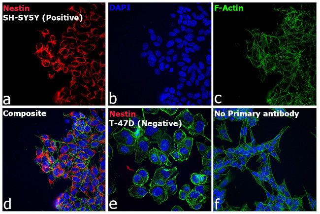 Mouse IgG (H+L) Highly Cross-Adsorbed Secondary Antibody in Immunocytochemistry (ICC/IF)