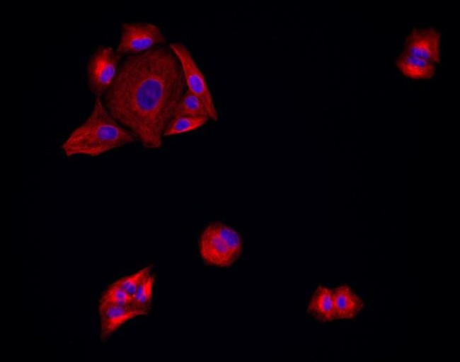 Mouse IgG (H+L) Highly Cross-Adsorbed Secondary Antibody in Immunocytochemistry (ICC/IF)