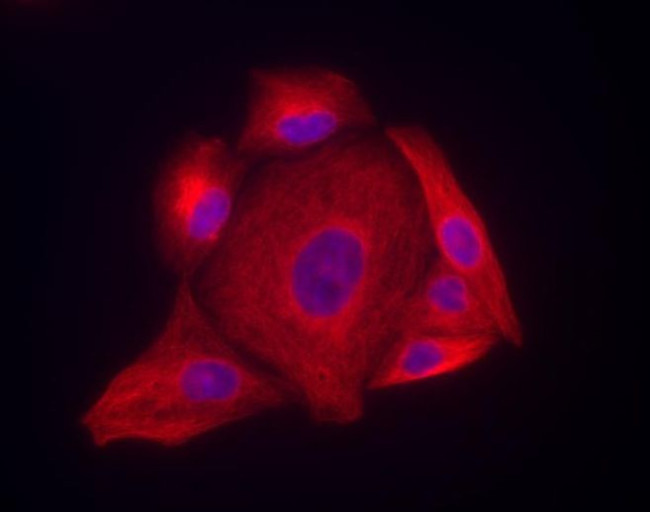 Mouse IgG (H+L) Highly Cross-Adsorbed Secondary Antibody in Immunocytochemistry (ICC/IF)