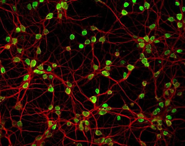 Rabbit IgG (H+L) Highly Cross-Adsorbed Secondary Antibody in Immunocytochemistry (ICC/IF)