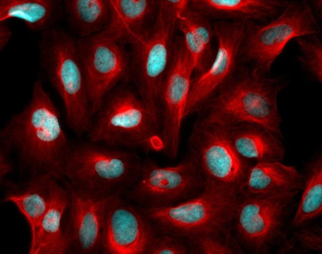 Goat IgG (H+L) Highly Cross-Adsorbed Secondary Antibody in Immunocytochemistry (ICC/IF)